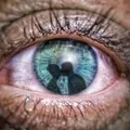 tipos-de-analgesicos