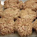 neuronas-bipolares