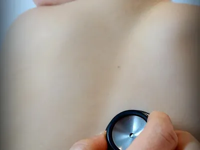 tratamientos para la bronquitis